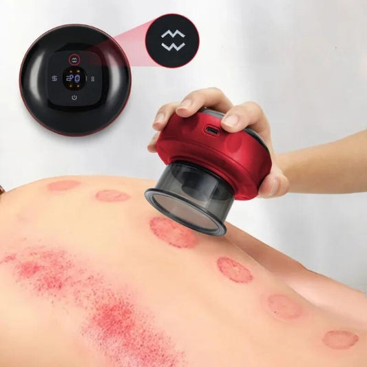 Electric Cupping Therapy Set - Trend Junction 