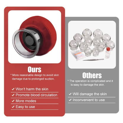 Electric Cupping Therapy Set - Trend Junction 