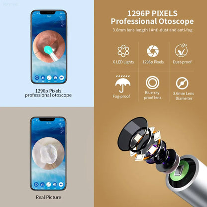 Smart Visual Ear Cleaner - Trend Junction 